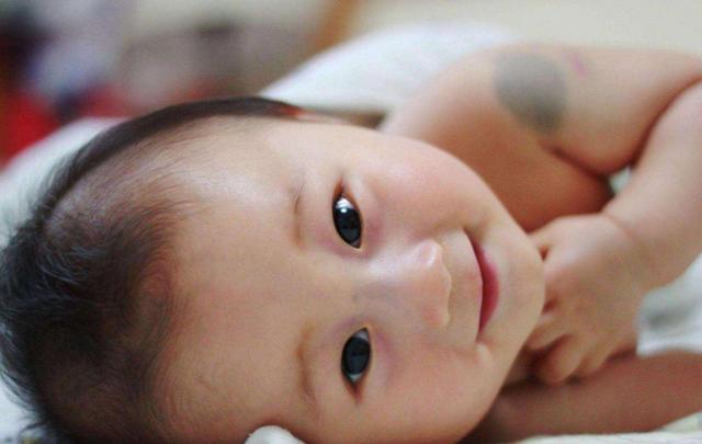 怎么预防儿童有胎记?儿科医生告诉你