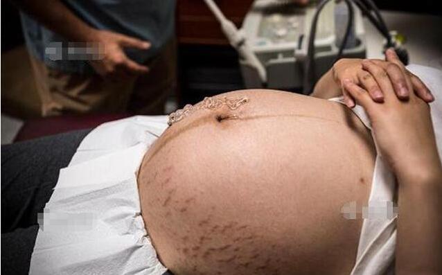 宝妈二胎没在意，肚子太大七个月才去产检，大夫怒吼早干嘛去了