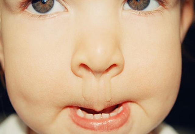 精选问答—入冬后，宝宝总流鼻涕该怎么办？这样的护理方式更有效