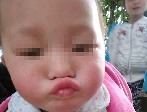 女儿总嘟嘟嘴，母亲觉得好玩，细心奶奶发现问题，掰开嘴巴蒙住了