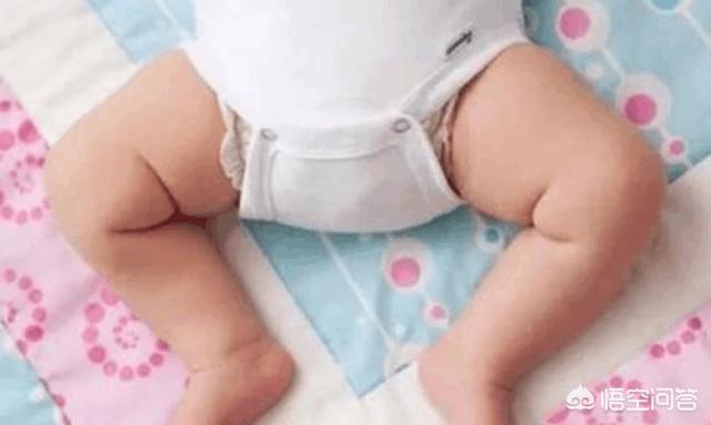 宝宝“青蛙腿”，大人需要纠正吗？