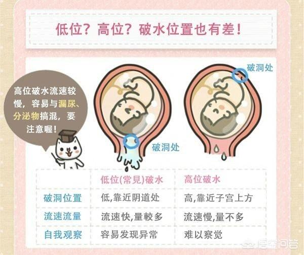 羊水破了是什么感觉？