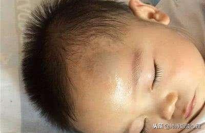 辟谣：宝宝头上磕了一个包，揉一揉能消肿？其实处理不当才更危险