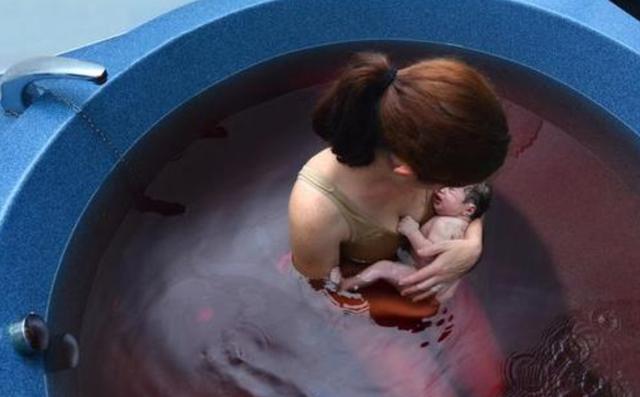 水中分娩有什么好处？哪些情况下，孕妇不能够进行水中分娩？