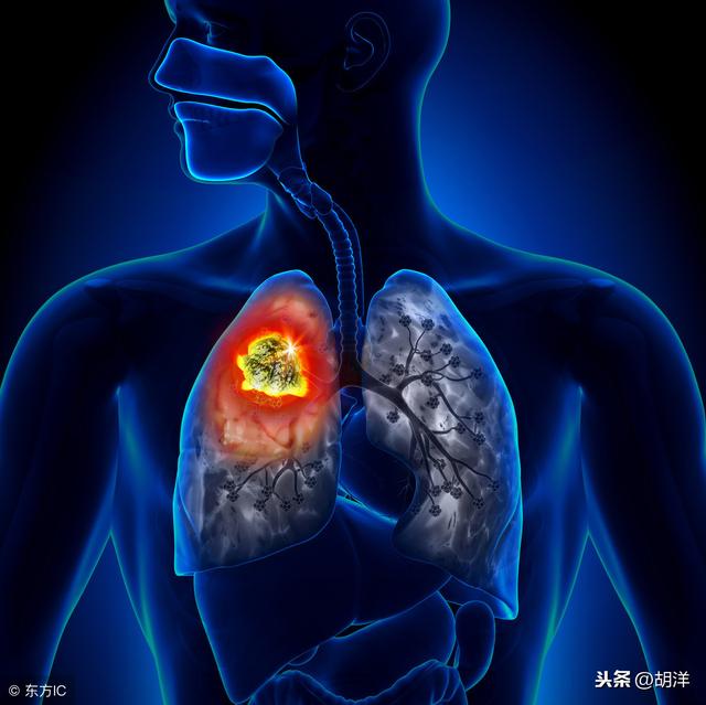 �ΰ�ת��֢״����Щ����Щ֢״�����ڷβ�֢״֮ǰ�����׵�������