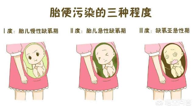 胎儿最怕羊水混浊，准妈妈应该如何预防？