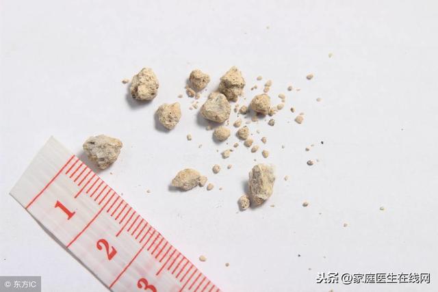 才5个月大就长了肾结石？这3种食物，不能过早给孩子吃