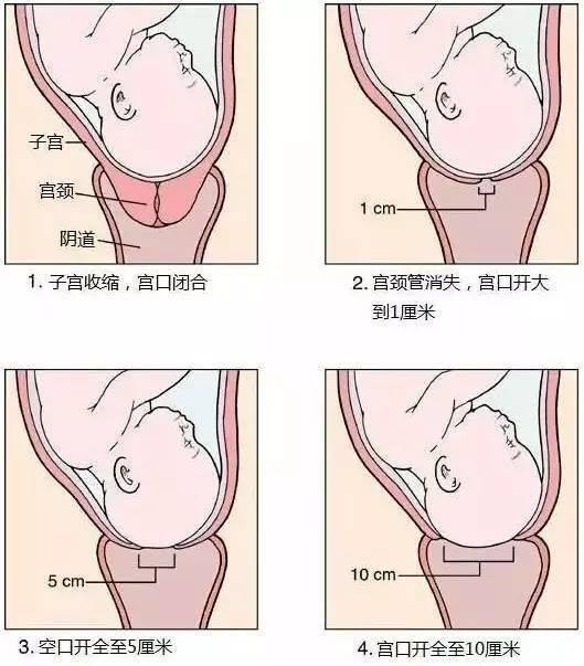 顺产开十指究竟有多么疼痛？很多产妇开到4指就受不了了