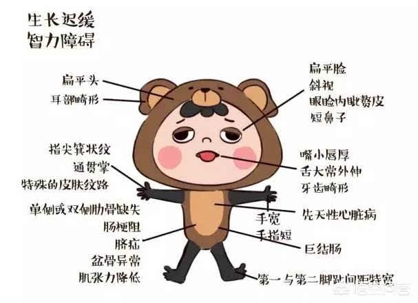 产检时医生告诉我宝宝是傻的怎么办？别急，看看这项检查做了没
