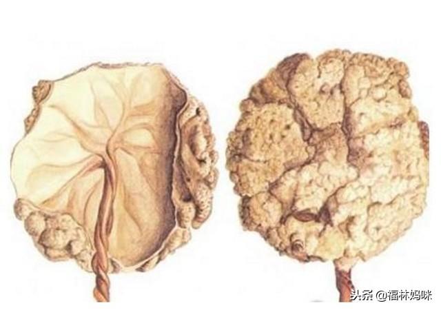 你的胎盘如何处置？常见的3种胎盘处置方法，原来这种最合理