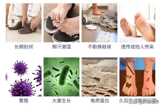 去味、除臭、杀菌，1秒除臭不伤鞋袜不伤脚！