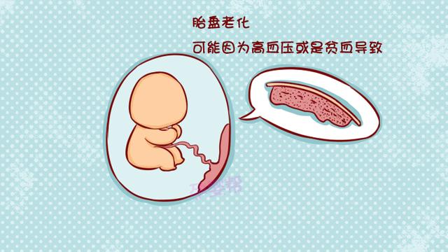 孕23周胎盘成熟1级什么意思？妇产科医生这样解释！