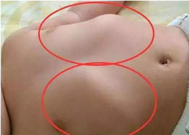 孩子这种表现不是缺钙！妈妈你别再被坑了