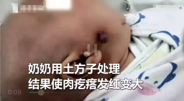 家人给孩子祛除肉疙瘩竟引发颅内感染！这些疙瘩你真的分清了吗？