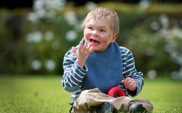 男孩13岁还像婴儿一样，大脑和身体停止发育，诊断为不知名疾病