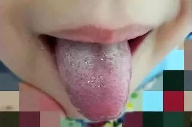 育儿必学小知识：教你如何看孩子舌苔学辩证，简单易学！