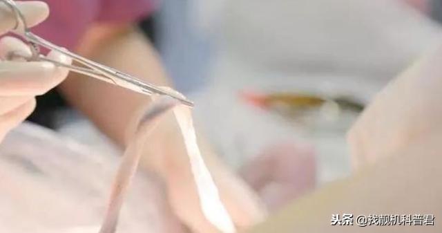 脐带剪断时，到底是妈妈疼还是宝宝疼？