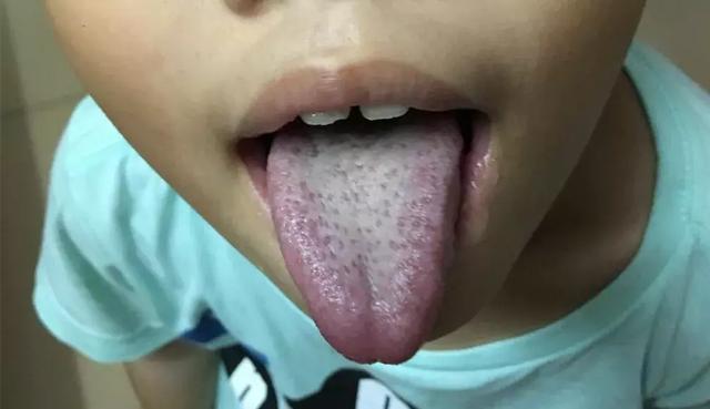 长期便秘，羊屎蛋，便秘腹泻交替的根本原因