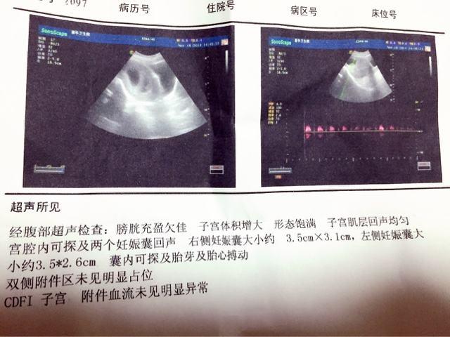 音乐胎教怎么做？到底要不要买胎教仪？