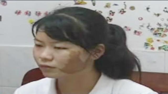 孕期常做5件事，宝宝容易长胎记，孕妈记得别忽视！