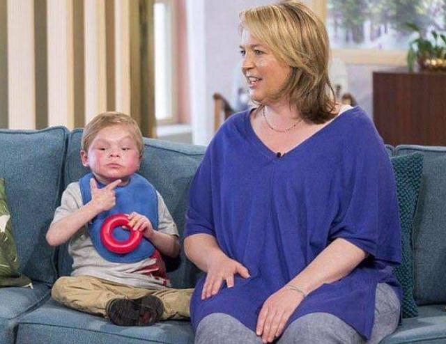 男孩13岁还像婴儿一样，大脑和身体停止发育，诊断为不知名疾病