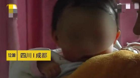 因家长在宝宝3天大时开始喂辅食，5个月的女婴双肾长满结石