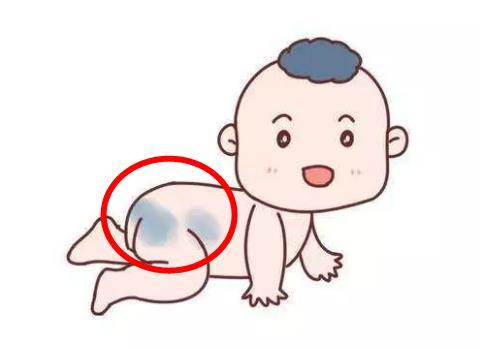 胎记影响宝宝颜值，这3种胎记更是“危险信号”，家长要注意