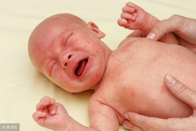 宝宝发烧怎么物理降温？不清楚的爸妈快来看~