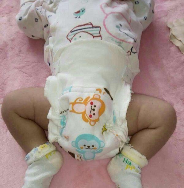 新生儿红屁屁怎么办？医生：教你3招预防，第2个需要细心呵护