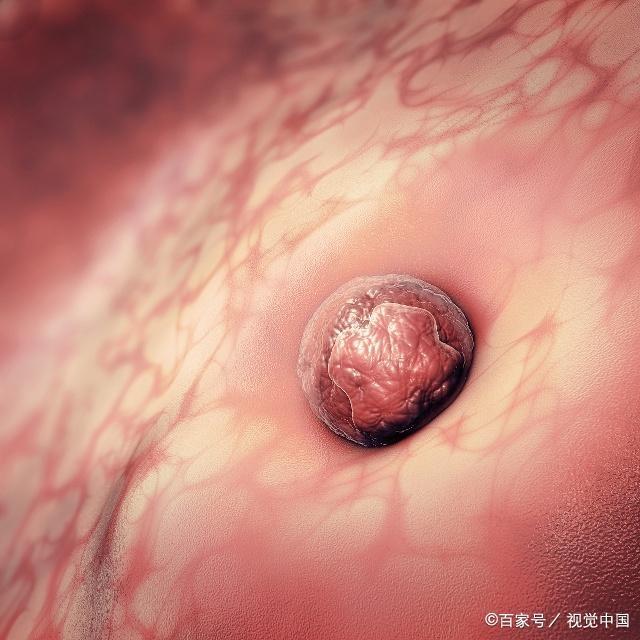 受精卵着床有感觉吗？排卵后7天左右，希望你出现这3个“感觉”！
