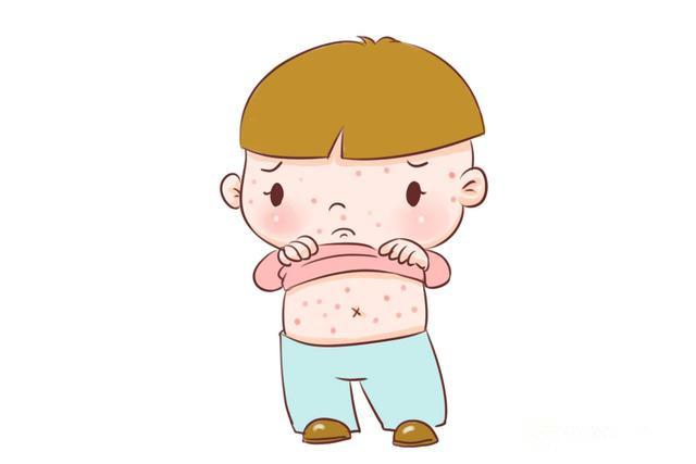 宝宝过敏体质是遗传！三大慢性过敏症状知多少？