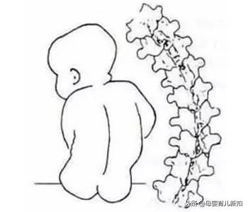 6个月宝宝脊椎严重变形？“带娃小帮手”的5个使用注意事项要知道
