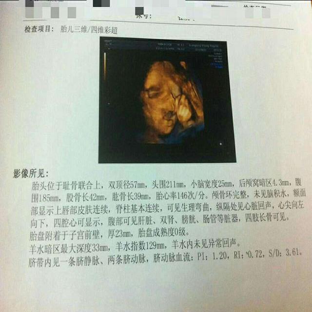 医生说30周B超只看生长情况不看内脏，很担心怎么办？准妈妈着急