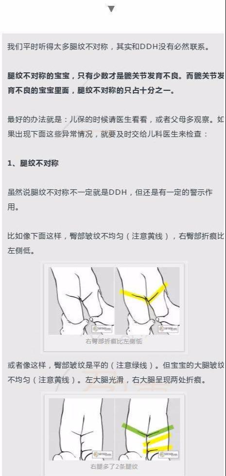 宝宝这个部位不对称，以后走路可能老摔跤，幸亏宝妈发现得早