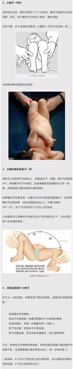 宝宝这个部位不对称，以后走路可能老摔跤，幸亏宝妈发现得早