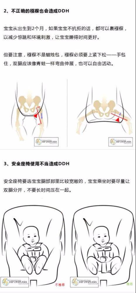 宝宝这个部位不对称，以后走路可能老摔跤，幸亏宝妈发现得早