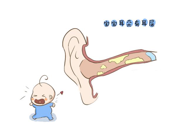 宝宝的耳朵里有耳屎不能掏?那到底该怎么办,了解以下几点不要慌