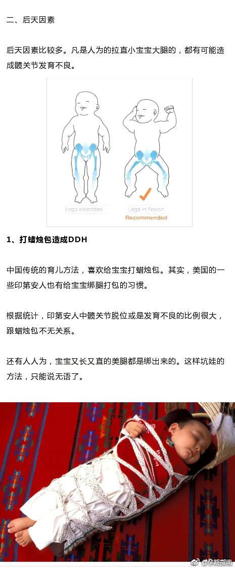 宝宝这个部位不对称，以后走路可能老摔跤，幸亏宝妈发现得早