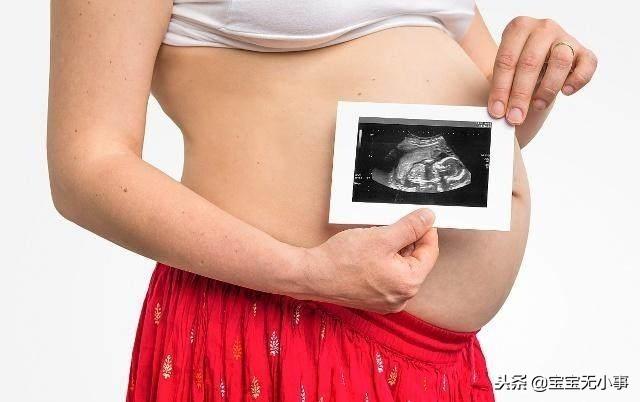 顺产也挑人，有这3个特征的孕妇，要做好剖腹产的准备