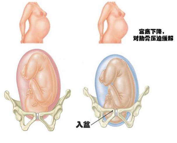 胎儿迟迟不入盆？你得看人下菜才行！
