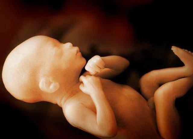 怀孕7个月孕妇坐骨神经痛、抽筋 重点预防：妊娠糖尿病和高血压