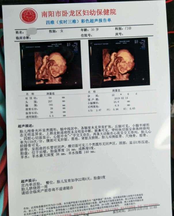 四维彩超报告单上的数据，你看懂了吗？3分钟让你更详细了解胎宝