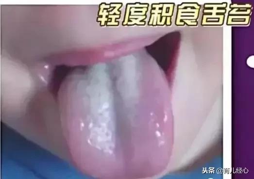 过度喂养危害大，宝宝发出的积食信号你能看懂多少