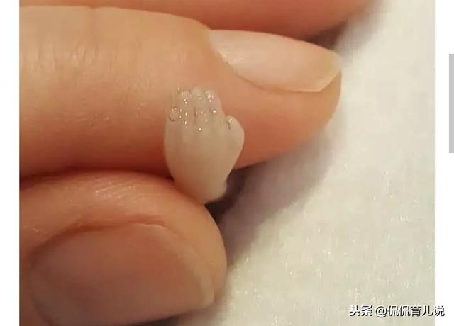 宝妈流产后将10cm胎儿放冰箱？还在网络晒照片劝孕妈们：别堕胎！