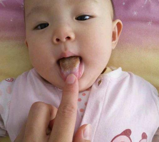 积食的孩子，身体主要有这5个反应，家长可别疏忽了！