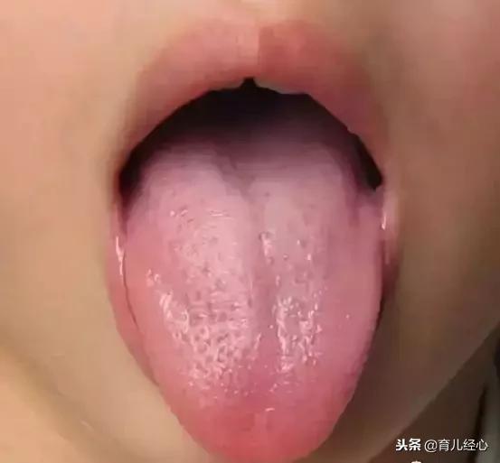 过度喂养危害大，宝宝发出的积食信号你能看懂多少