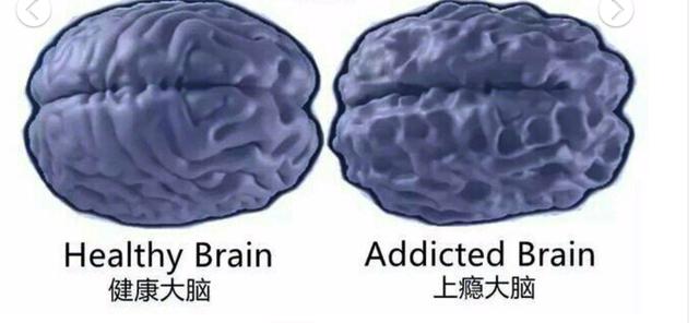 沉迷手机与不玩手机的孩子相比，大脑有啥区别？触目惊心！