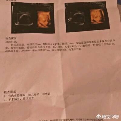 怀孕24周胎儿有多大了呢？