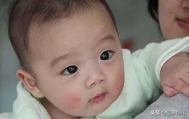 冬天不注意宝宝皮肤的这3种情况,宝宝就要变丑啦!宝妈快看看吧