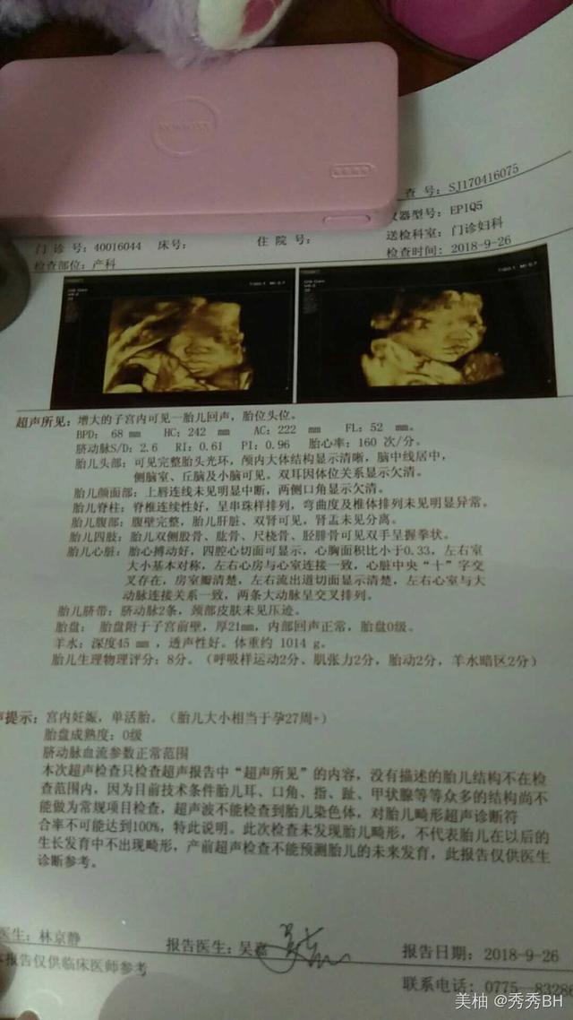 顺产男宝6斤，说说孕期全部身体变化，破水以后，十多分钟就生了